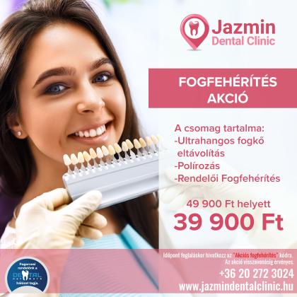 Fogfehérítés AKCIÓ Fogfehérítés AKCIÓ