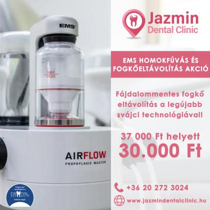 EMS Homokfúvás és Fogkőeltávolítás AKCIÓ!