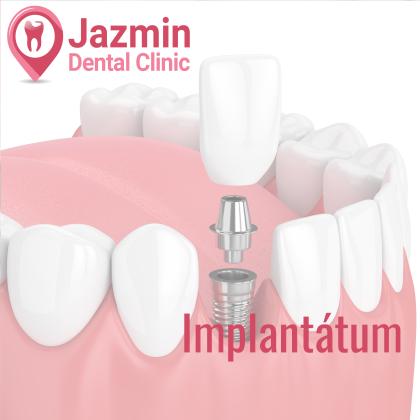 Implantology